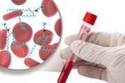 main illustration image - MTBE Lipid Extraction